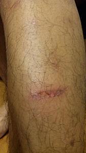 Burned my leg with exhaust-dvc00347.jpg