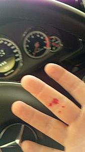 Sharp steering wheel pieces cut me!  E63 BiTurbo-e63bitme.jpg